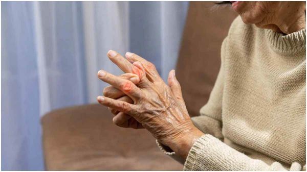 World Arthritis Day : अर्थराइटिस के इन शुरुआती लक्षणों को समय रहते जरूर पहचान लें